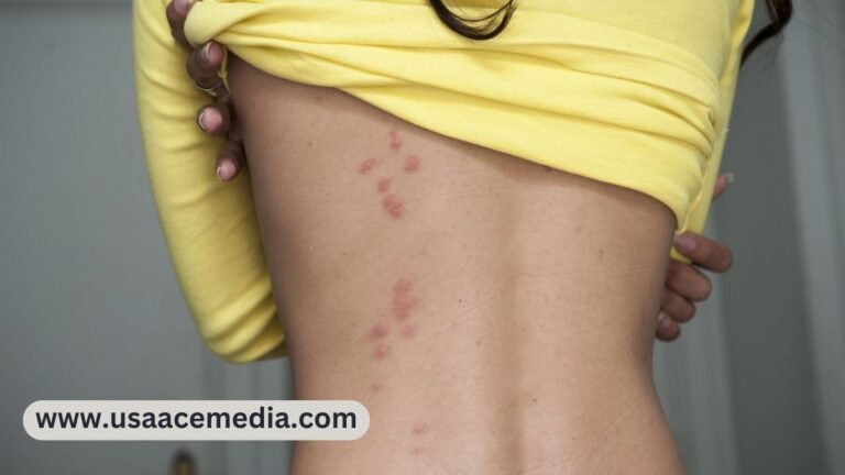 Itchy Bumps on Skin Like Mosquito Bites but Aren't